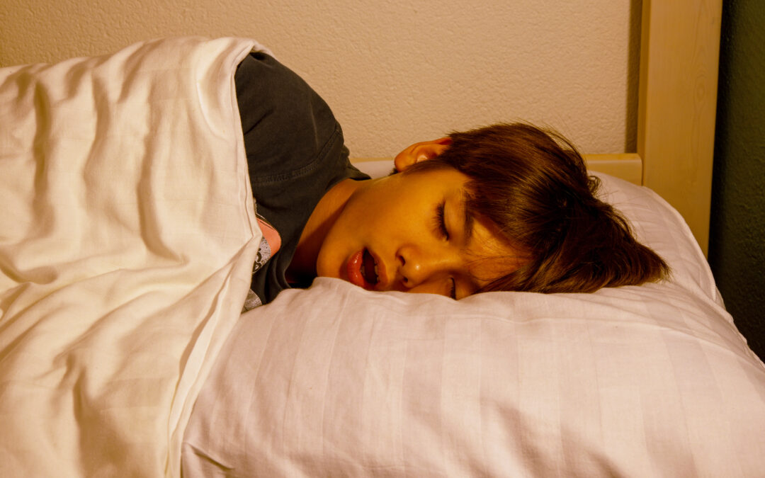 Sleep apnea in children
